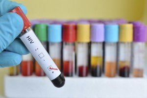 Imagem colorida mostra teste de HIV guardado em vários recipientes com sangue