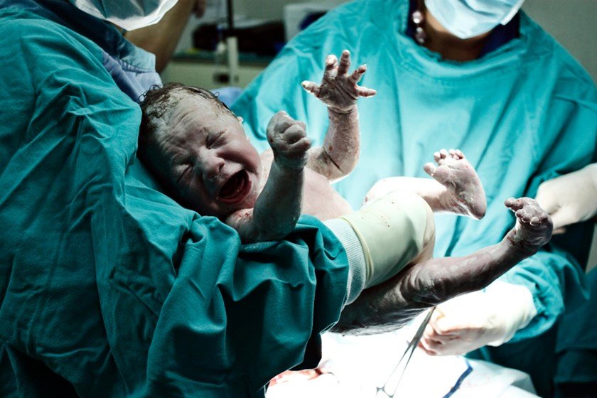 Na foto, um bebê recém nascido
