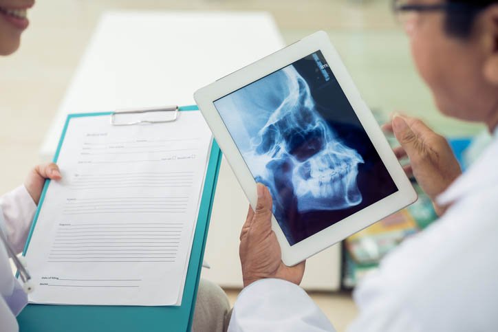 Skull x-ray raio x mafia das proteses medico radiografia