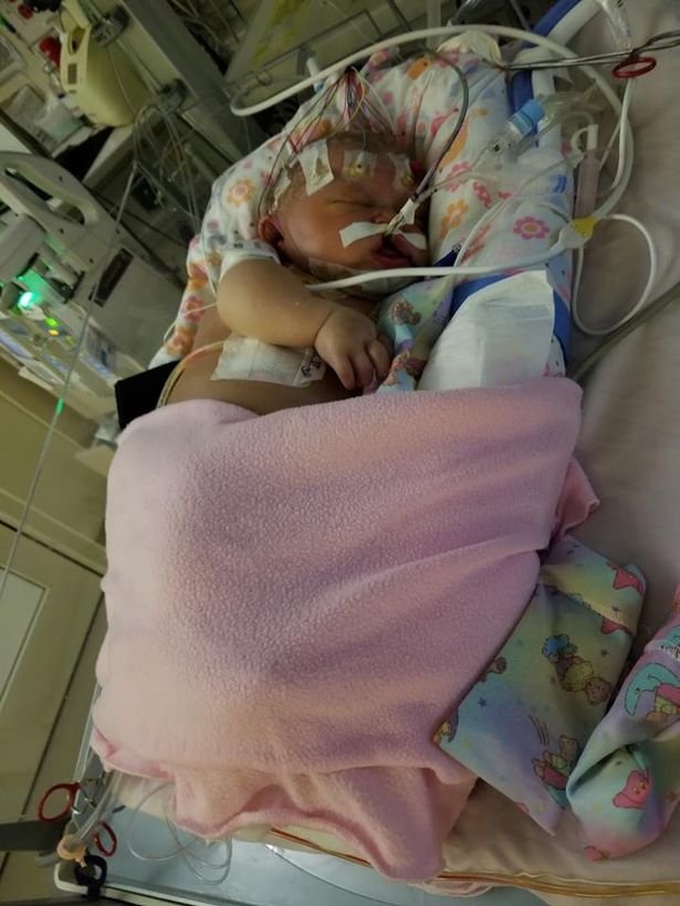 Newborn-baby-girl-dies-just-days-after-contracting-a-killer-virus-from-someone-with-HERPES-who-kisse5