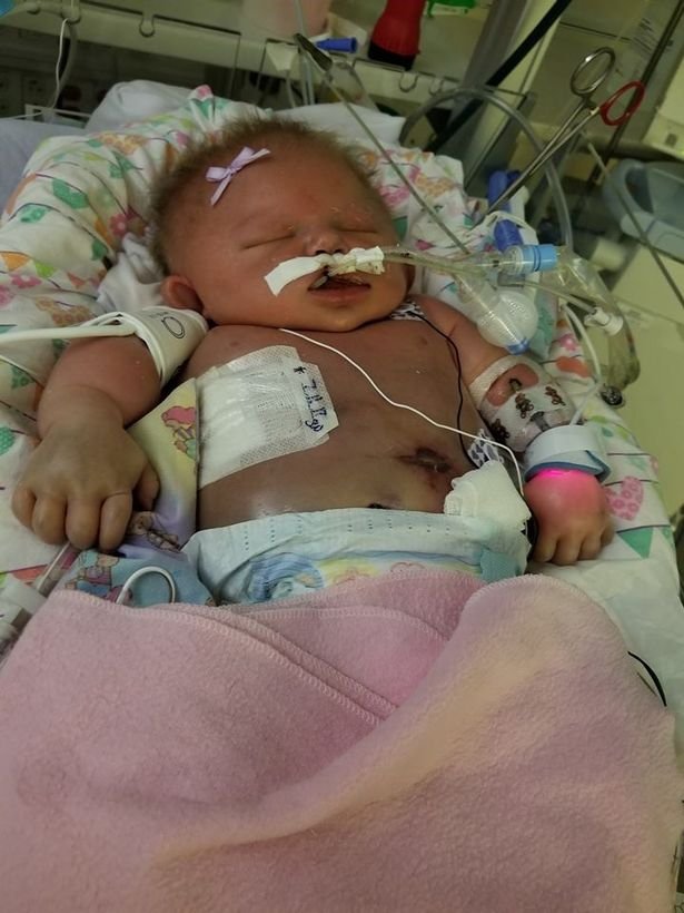 Newborn-baby-girl-dies-just-days-after-contracting-a-killer-virus-from-someone-with-HERPES-who-kisse3