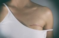 iStock