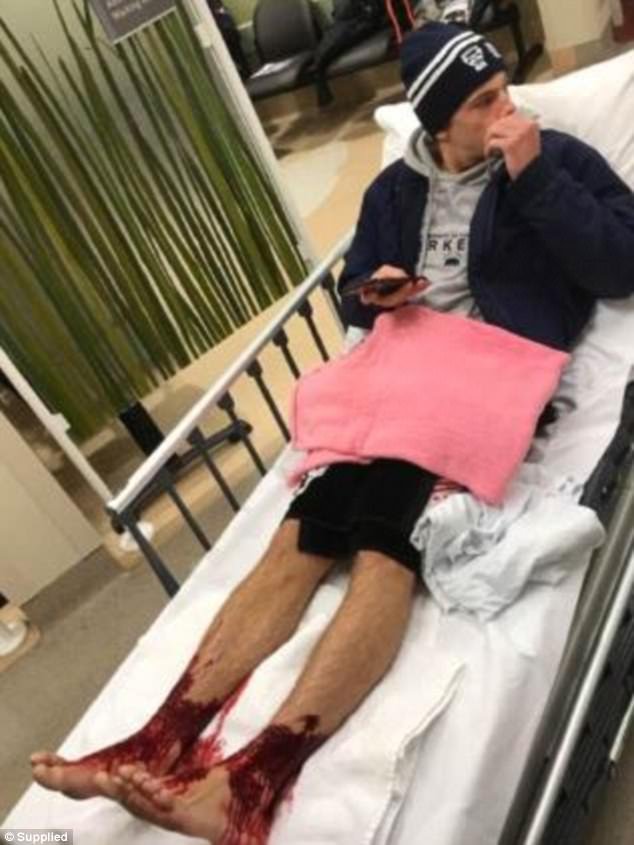 4303760200000578-4767448-Doctors_struggled_to_explain_the_teenager_s_mysterious_injuries_-a-15_1502101245947