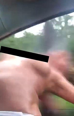acidente topless