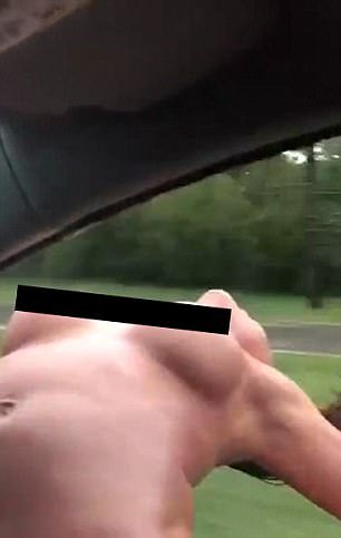 acidente topless