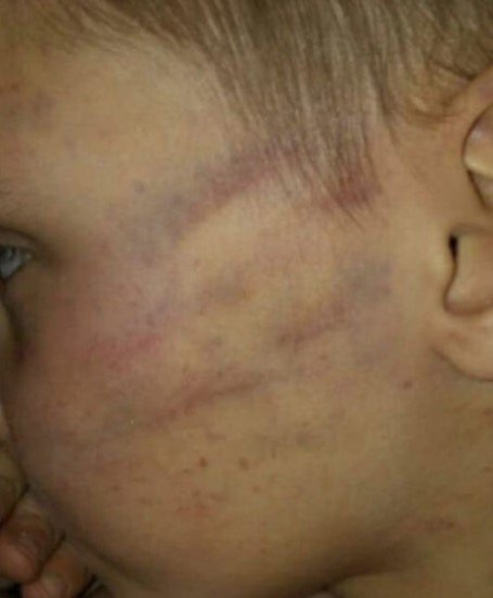 Facebook/Reprodução