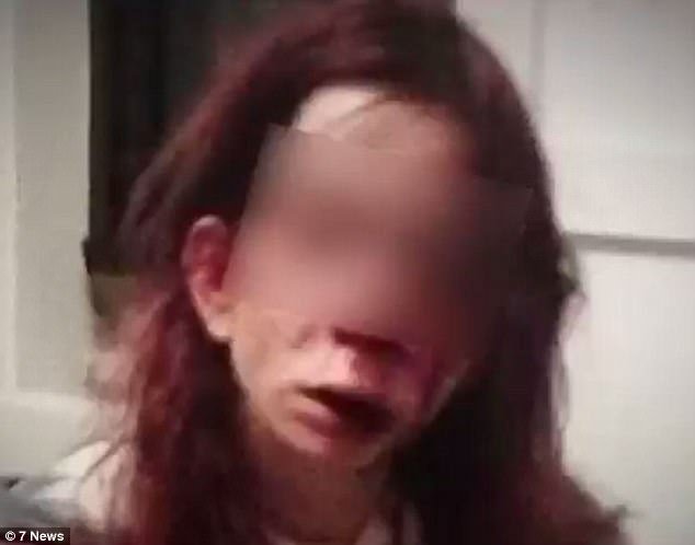 4838EE1100000578-5278213-The_victim_pictured_was_taken_to_hospital_after_the_attack_where-a-1_1516200138163