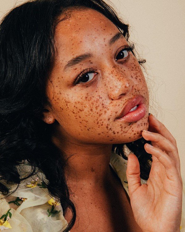 O rosto de Salem Mitchell virou marca registrada de marcas como American Eagle e GAP. Com apenas 19 anos, ela mais de 174 mil seguidores no Instagram