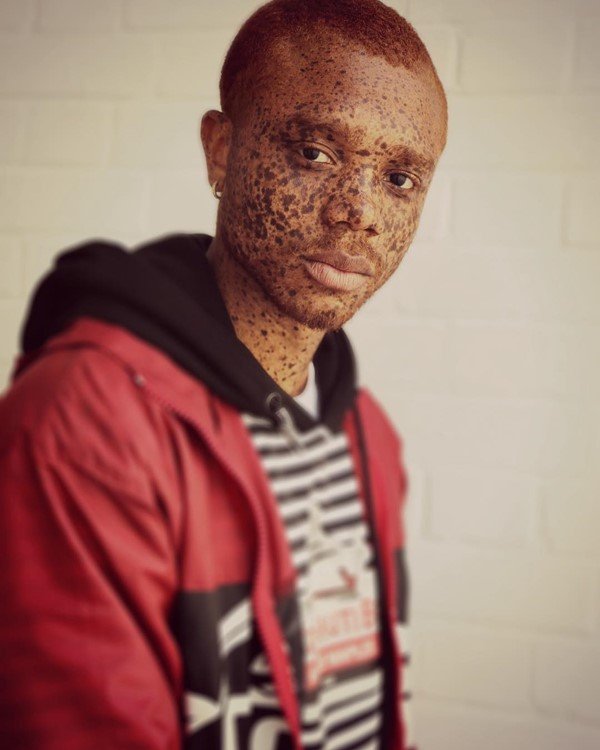 Símbolo da diversidade no mundo da moda, Ralph Souffrant nasceu no Haiti. Tem uma condição na pele que lembra vitiligo. Foi em Nova York que ele começou carreira como modelo