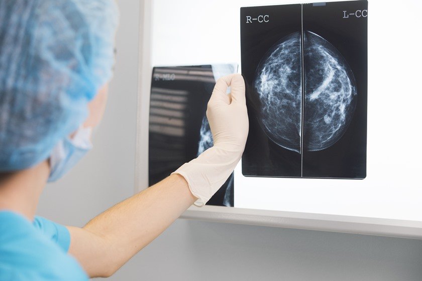Mamografia 3D revoluciona diagnóstico de doenças com imagens precisas