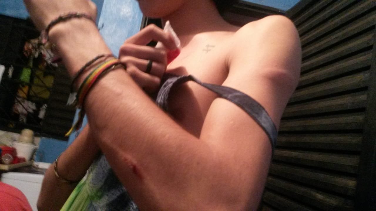Agressão 3