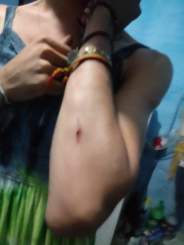 Agressão 2