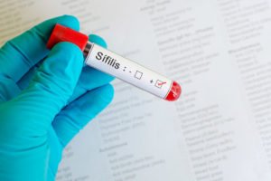 Mitos e verdades sobre a sífilis, doença milenar que preocupa o país