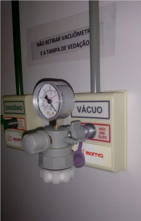 Sucção de secreção