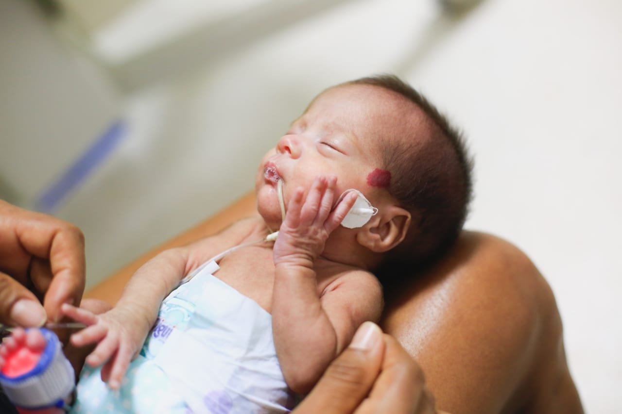 Bebês internados em maternidade escola ganham mesversários da equipe  Neonatal; veja fotos - Ceará - Diário do Nordeste