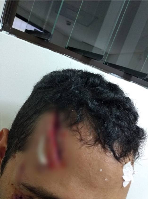 Agressão 1