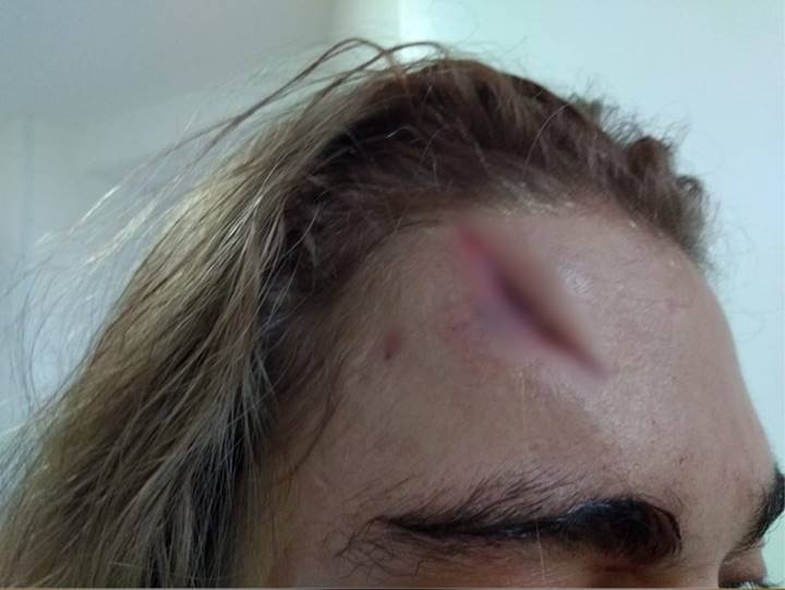 Agressão 4