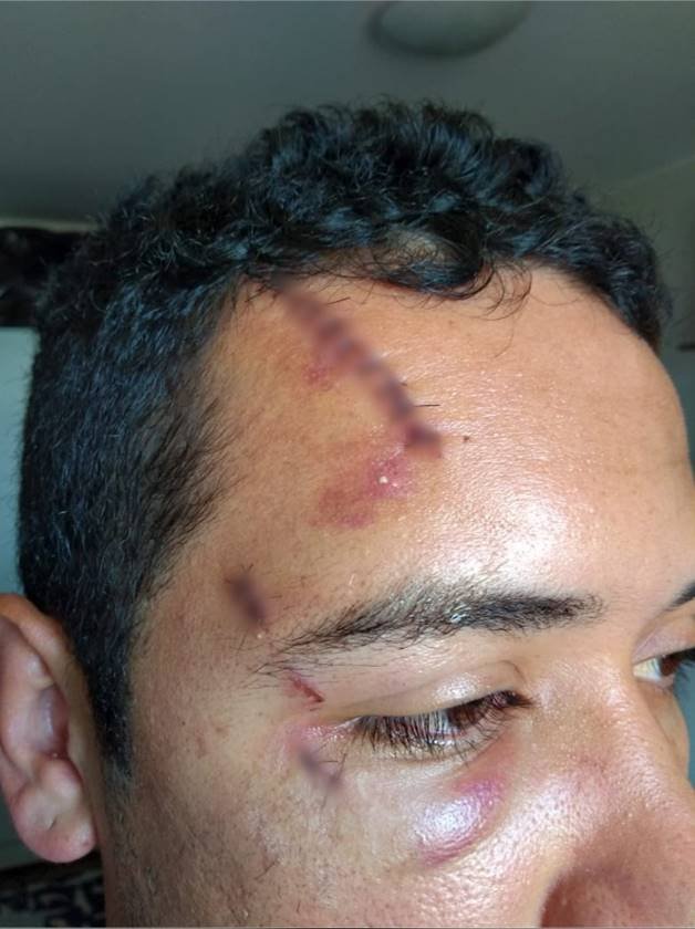 Agressão