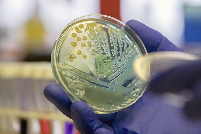 Mucoid colonies of the pathogenic multi-drug resistant Klebsiella pneumoniae on CLED agar plate. This particular strain of coliform bacteria isolated in the laboratory is positive for both the ESBL and Carbapenemase gene.