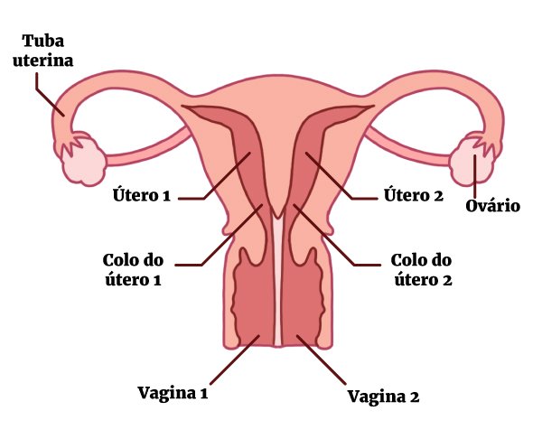 Condição rara faz mulher ter duas vaginas e menstruar duas vezes