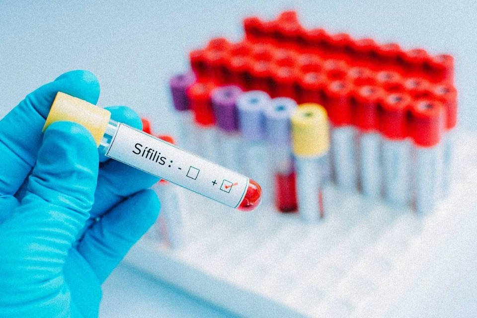 exame-teste-sifilis