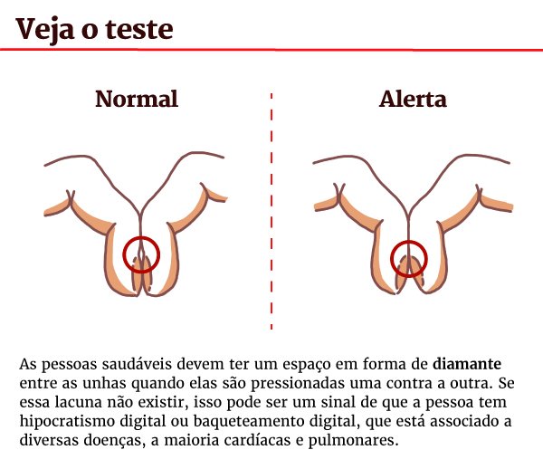 Teste simples com os dedos pode revelar se você está doente