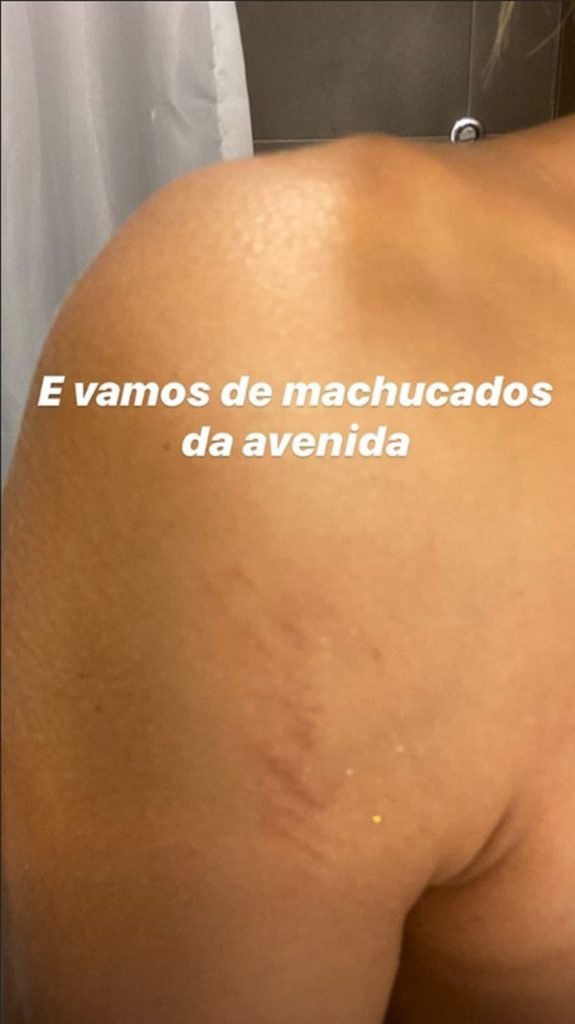 lexa