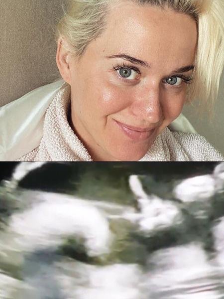 Katy Perry ultrassom