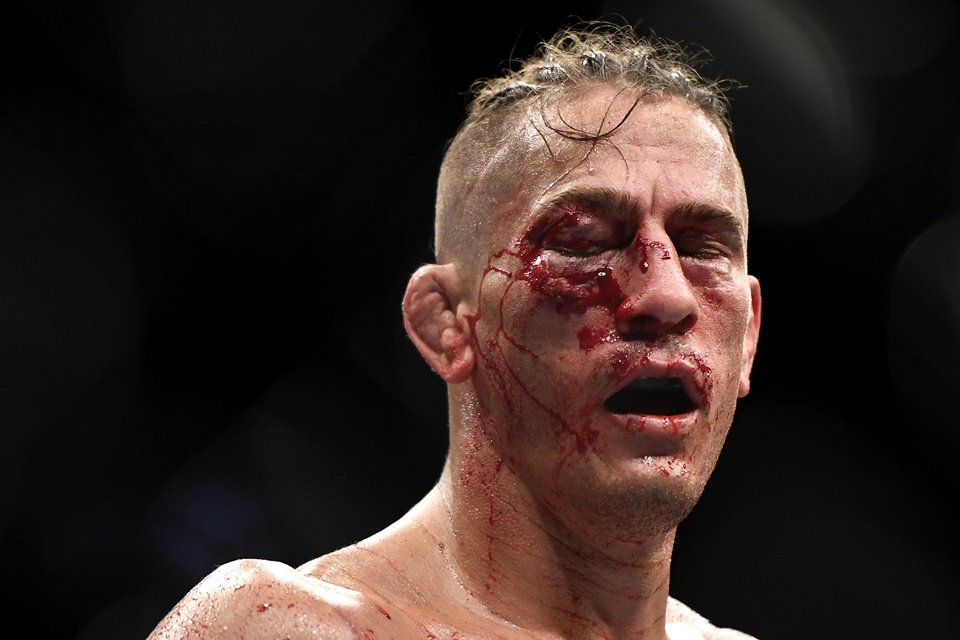 Niko Price com rosto machucado após UFC 249