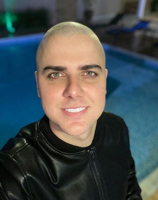 Zé Neto careca