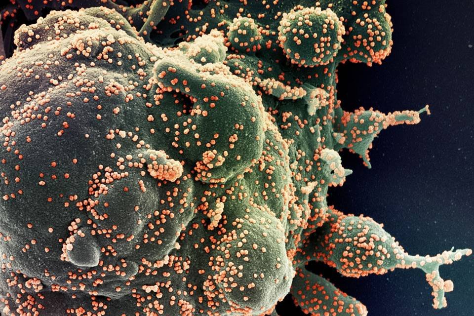 Imagem-coronavírus-SarsCov2_Niaid