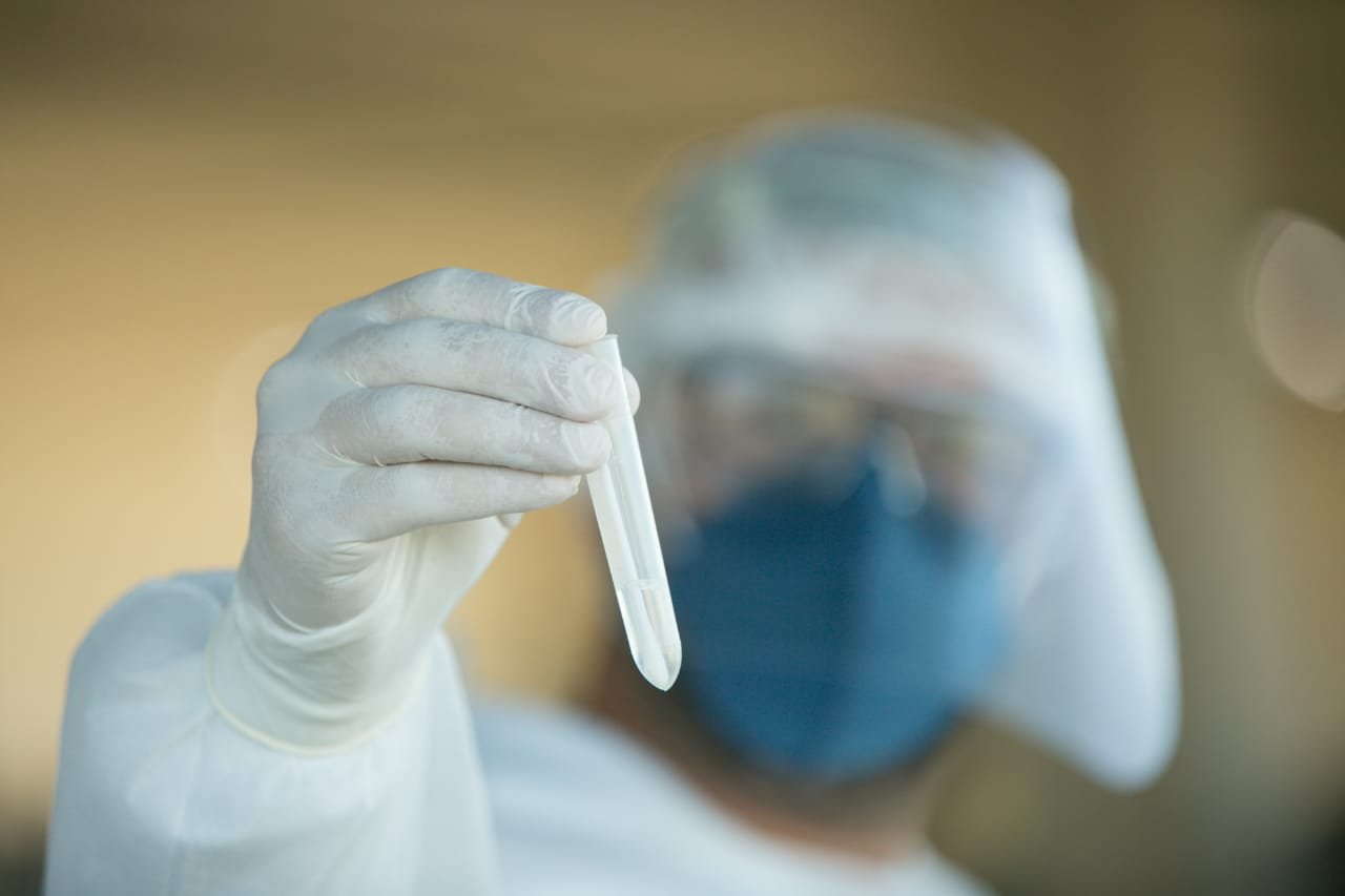 Homem com máscara, óculos, touca e luva mostrando um tubo de ensaio