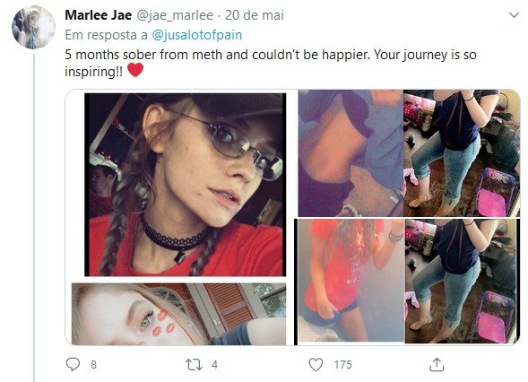 Seguidora de Travis Robinson mostra antes e depois das drogas