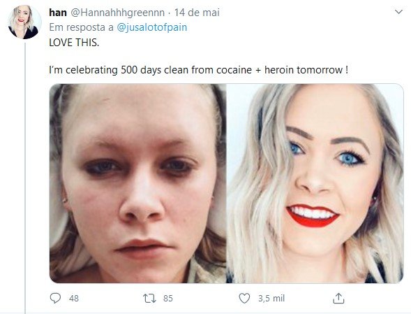 Seguidora de Travis Robinson mostra antes e depois das drogas