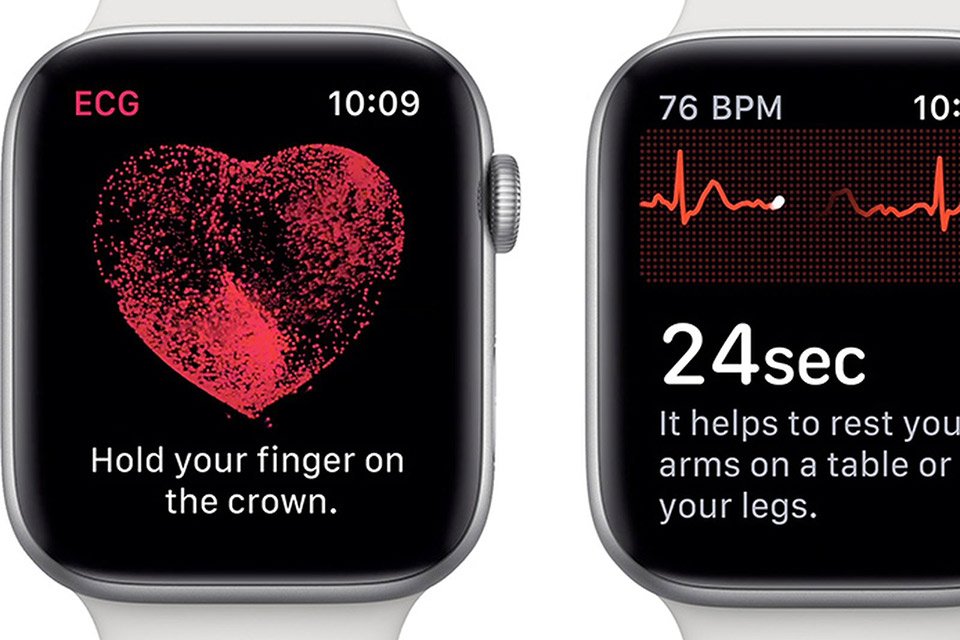 Apple confirma que ECG do Apple Watch será liberado no Brasil com watchOS  6.2.8