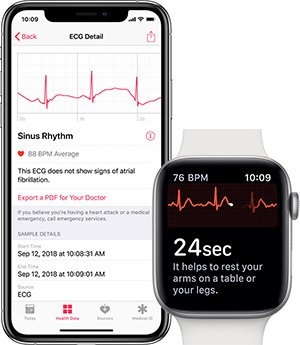 Apple confirma que ECG do Apple Watch será liberado no Brasil com watchOS  6.2.8