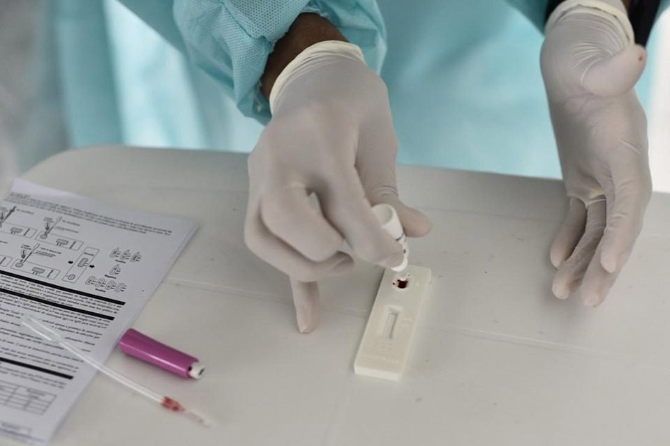 Exame para coronavírus no DF