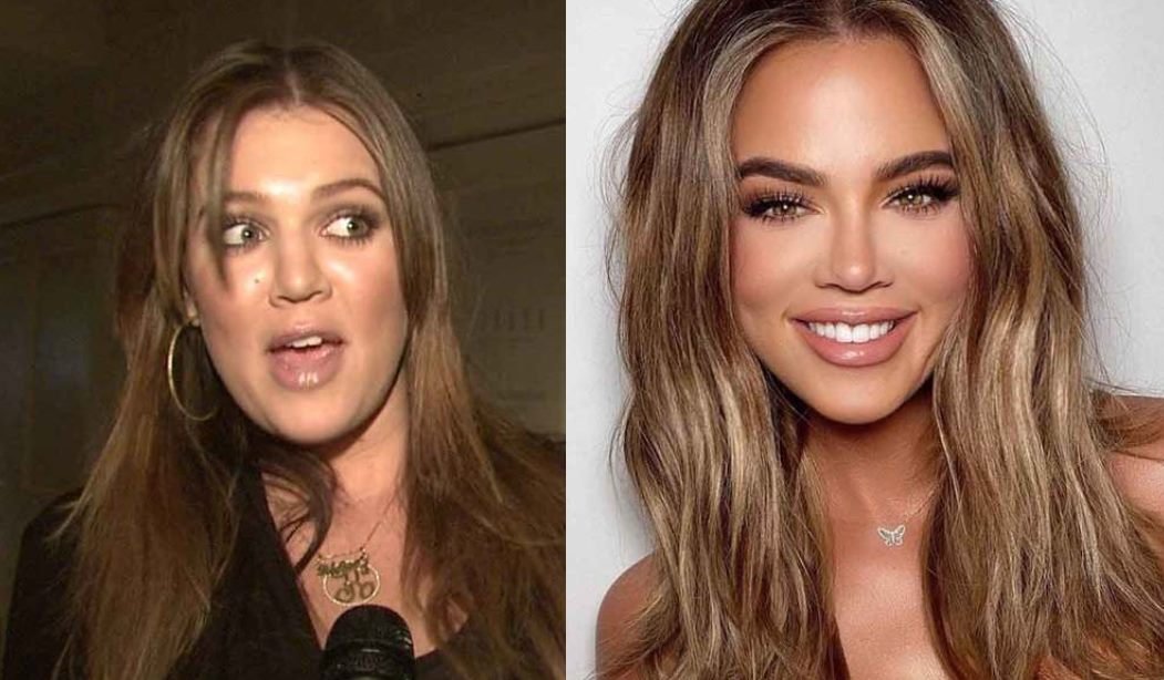 Mudanças radicais de Khloé Kardashian