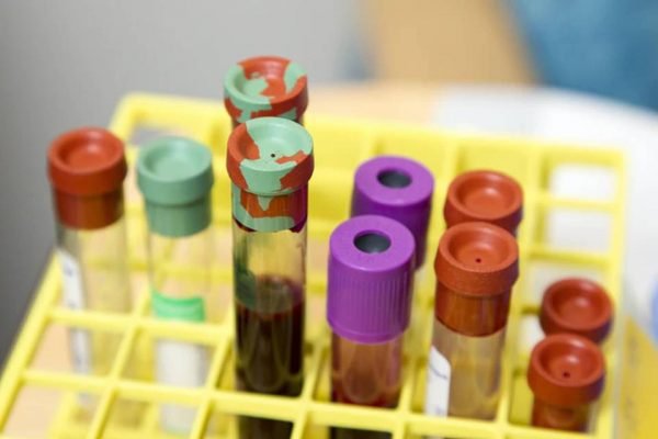 Fotografia colorida de tubos de coleta de Exame de sangue