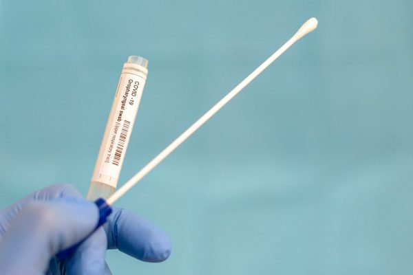 Fotografia colorida de teste RT-PCR é uma metodologia que utiliza a biologia molecular para detectar o vírus na secreção respiratória, por meio de uma cotonete