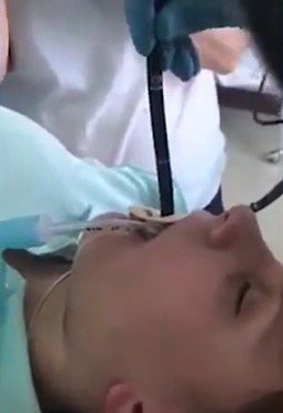 Médicos retiram cobra de dentro de mulher4