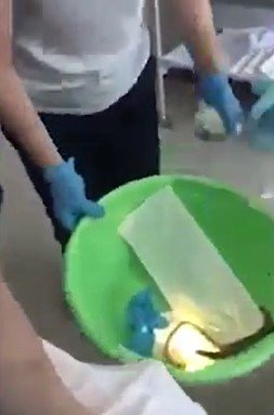 Médicos retiram cobra de dentro de mulher4