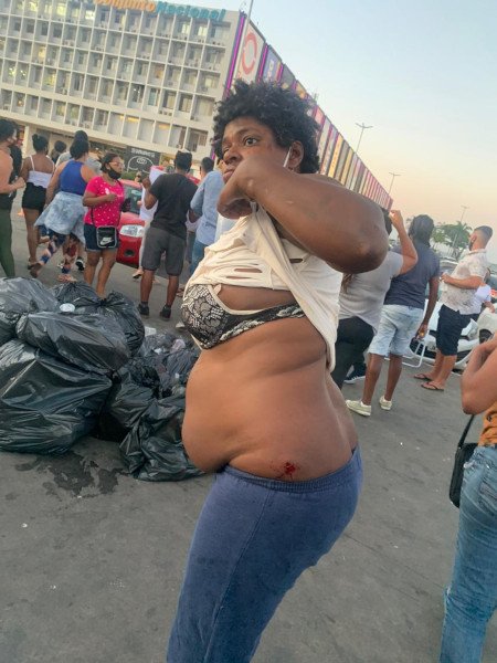 Ambulante mostra machucados