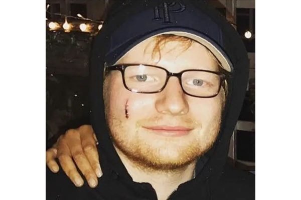 Ed Sheeran usando óculos de grau e boné - Metrópoles