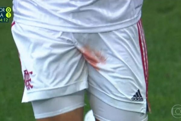 Jogador do Flamengo lesiona o testículo