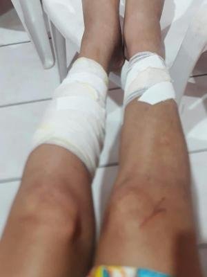 garota de programa trans leva mais de 30 facadas em SC