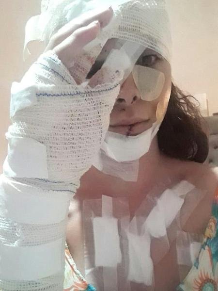 garota de programa trans leva mais de 30 facadas em SC