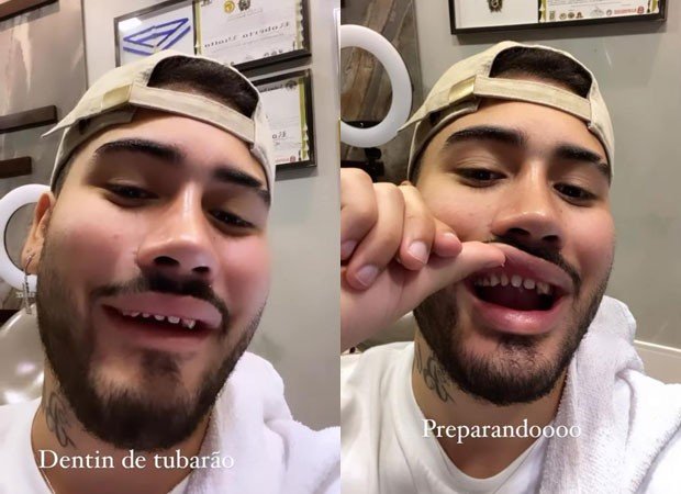 Kevinho aparece sem lente de contato nos dentes e vira meme na web