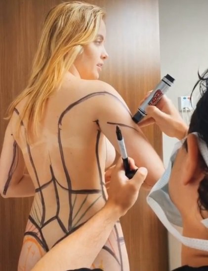 Giovanna Chaves antes da cirurgia