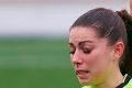 Sara Fernandez com hematoma no olho